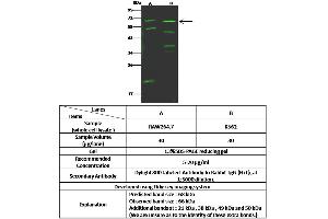 Image no. 1 for anti-Interleukin 18 Receptor Accessory Protein (IL18RAP) (AA 1-357) antibody (ABIN6925777)