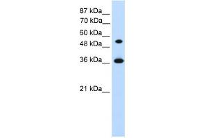 Image no. 1 for anti-Homeobox C11 (HOXC11) (Middle Region) antibody (ABIN2779771)