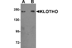 Image no. 2 for anti-Klotho (KL) (Middle Region) antibody (ABIN1030975)