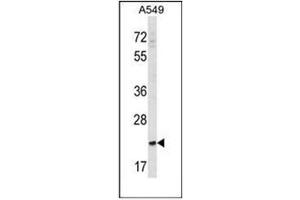 SLAMF9 antibody  (C-Term)