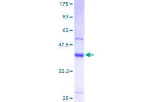 Image no. 1 for tRNA Methyltransferase 11-2 (TRMT112) (AA 1-125) protein (GST tag) (ABIN1307237)