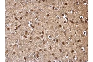 IHC-P Image DDB1 antibody [C3], C-term detects DDB1 protein at cytosol and nucleus on mouse hind brain by immunohistochemical analysis.