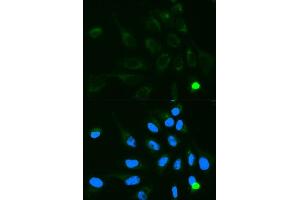 Image no. 1 for anti-UDP Glucuronosyltransferase 1 Family, Polypeptide A9 (UGT1A9) antibody (ABIN3022343)