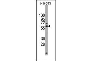 Image no. 1 for anti-Dihydropyrimidinase-Like 2 (DPYSL2) antibody (ABIN4948375)