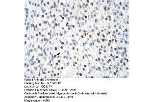 Image no. 5 for anti-Musashi Homolog 2 (MSI2) (N-Term) antibody (ABIN2776629)