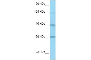 Image no. 1 for anti-Complement Factor H-Related 1 (CFHR1) (C-Term) antibody (ABIN2789086)
