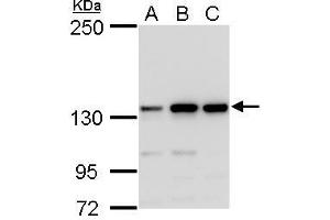 Image no. 1 for anti-MutS Homolog 3 (MSH3) (N-Term) antibody (ABIN2855583)