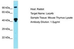 Image no. 1 for anti-La Ribonucleoprotein Domain Family, Member 4B (LARP4B) (AA 141-190) antibody (ABIN6750303)