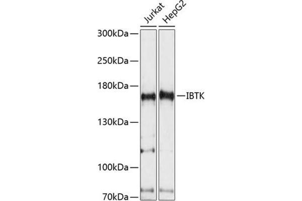 IBTK antibody  (AA 900-1200)