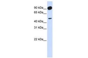 Image no. 1 for anti-Adducin 2 (Beta) (ADD2) (AA 648-697) antibody (ABIN6741133)