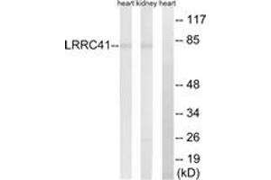 Image no. 1 for anti-Leucine Rich Repeat Containing 41 (LRRC41) (AA 391-440) antibody (ABIN1535000)