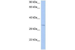 Image no. 1 for anti-N-Ethylmaleimide Sensitive Fusion Protein Attachment Protein beta (NAPB) (N-Term) antibody (ABIN926982)