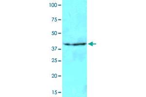 Image no. 2 for anti-N-Acetyltransferase 6 (GCN5-Related) (NAT6) antibody (ABIN5584205)