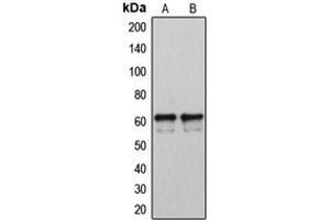Image no. 3 for anti-Cytochrome P450, Family 2, Subfamily U, Polypeptide 1 (CYP2U1) (Center) antibody (ABIN2705993)