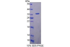 Image no. 1 for CD34 (CD34) (AA 32-290) protein (His tag) (ABIN1981033)
