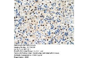 Image no. 3 for anti-Zinc Finger Protein 326 (ZNF326) (C-Term) antibody (ABIN2778596)