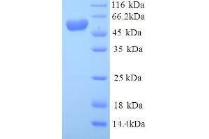 Image no. 1 for Mdm2, p53 E3 Ubiquitin Protein Ligase Homolog (Mouse) (MDM2) (AA 1-489), (full length) protein (His tag) (ABIN5713638)
