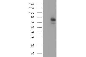 Image no. 2 for anti-Amylase, alpha 2A (Pancreatic) (AMY2A) (AA 135-408) antibody (ABIN2715974)