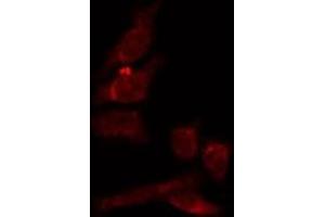 Image no. 2 for anti-Premelanosome Protein (PMEL) antibody (ABIN6264314)