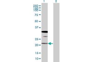 Image no. 1 for anti-SAR1 Homolog A (SAR1A) (AA 1-198) antibody (ABIN527950)