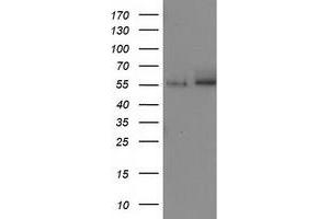 Image no. 1 for anti-Catalase (CAT) antibody (ABIN2717106)
