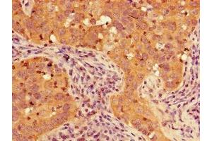 TIGAR antibody  (AA 24-188)