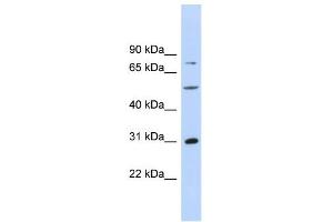 Image no. 3 for anti-Aspartate beta-Hydroxylase (ASPH) (Middle Region) antibody (ABIN2778321)