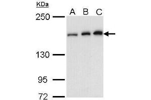 Image no. 4 for anti-rho-Associated, Coiled-Coil Containing Protein Kinase 1 (ROCK1) (N-Term) antibody (ABIN2856887)