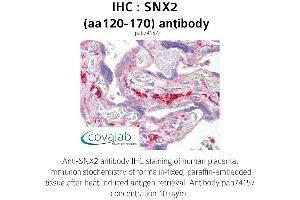 Image no. 1 for anti-Sorting Nexin 2 (SNX2) (AA 120-170) antibody (ABIN1739489)