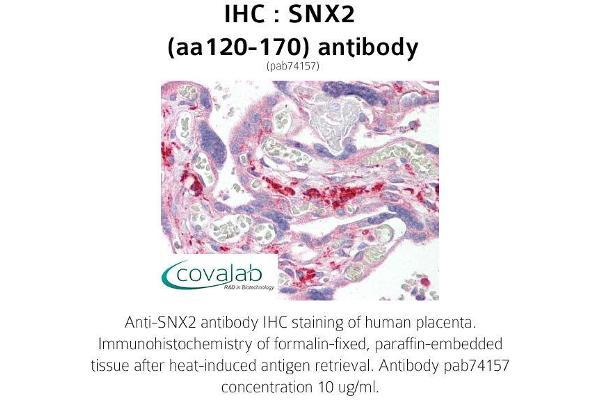 anti-Sorting Nexin 2 (SNX2) (AA 120-170) antibody