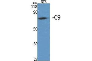 Image no. 2 for anti-Complement Component C9 (C9) (Internal Region) antibody (ABIN3180514)