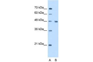 Image no. 3 for anti-Enolase 3 (Beta, Muscle) (ENO3) (N-Term) antibody (ABIN2783278)
