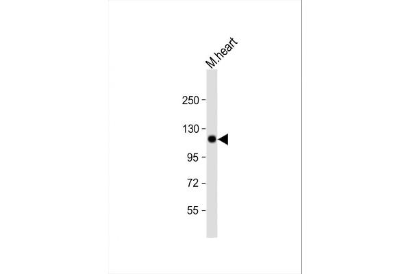 SCYL2 antibody  (AA 585-613)