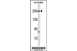 Image no. 2 for anti-Fatty Acid Synthase (FASN) (AA 942-973) antibody (ABIN1537694)