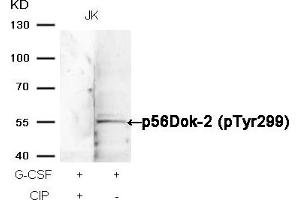 DOK2 anticorps  (pTyr299)