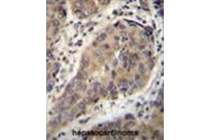 Image no. 1 for anti-Wilms Tumor 1 Interacting Protein (WTIP) (AA 474-503), (C-Term) antibody (ABIN955587)