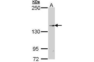 Image no. 3 for anti-Transient Receptor Potential Cation Channel, Subfamily M, Member 2 (TRPM2) (N-Term) antibody (ABIN2856853)