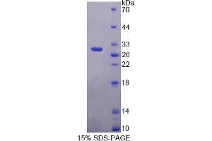 Image no. 1 for POU Class 5 Homeobox 1 (POU5F1) (AA 136-360) protein (His tag) (ABIN6237871)