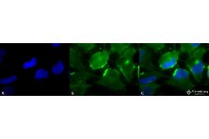 Image no. 1 for anti-HLA-DR-gamma (CD74) antibody (FITC) (ABIN2481709)