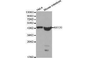 Image no. 9 for anti-Keratin 20 (KRT20) antibody (ABIN3020782)