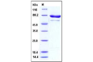 Image no. 1 for Protein Arginine Methyltransferase 5 (PRMT5) (AA 2-637) protein (DYKDDDDK Tag,His tag) (ABIN2003914)