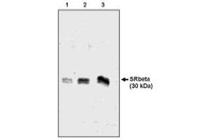 Image no. 1 for anti-Signal Recognition Particle Receptor, B Subunit (SRPRB) (AA 246-265) antibody (ABIN265297)
