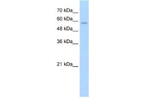 SLC22A16 抗体  (N-Term)