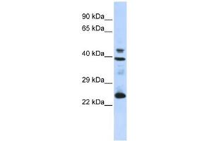 Image no. 1 for anti-Selenoprotein P (SEPP1) (N-Term) antibody (ABIN631287)