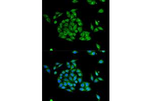 Image no. 1 for anti-Protein Interacting With Protein Kinase C, alpha 1 (PICK1) antibody (ABIN3022063)