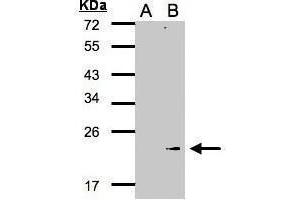 Image no. 2 for anti-Glutathione Peroxidase 7 (GPX7) (Center) antibody (ABIN2856159)