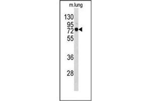 Image no. 2 for anti-Eukaryotic Elongation Factor, Selenocysteine-tRNA-Specific (EEFSEC) (AA 547-577), (C-Term) antibody (ABIN952028)