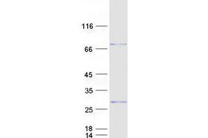 Image no. 1 for Cysteine-Rich Hydrophobic Domain 2 (CHIC2) protein (Myc-DYKDDDDK Tag) (ABIN2713975)