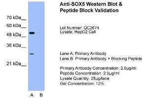 anti-SRY (Sex Determining Region Y)-Box 5 (SOX5) (C-Term) antibody