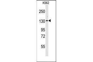 Image no. 1 for anti-Valyl-tRNA Synthetase (VARS) (N-Term) antibody (ABIN360195)
